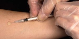 Tuberculosis: Estrategias para mejorar su tratamiento