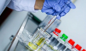 Univalle formula propuestas de investigaci&oacute;n para enfrentar al COVID-19