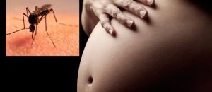 Una aproximaci&oacute;n al caso microcefalia &ndash; zika