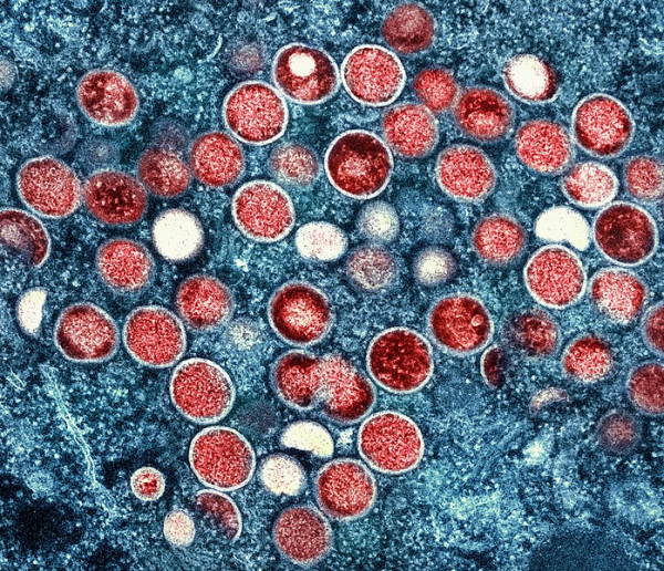 Virus_Mpox