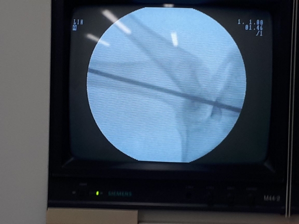 La Universidad patenta un cemento para pegar tejido &oacute;seo