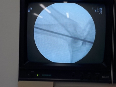 La Universidad patenta un cemento para pegar tejido &oacute;seo